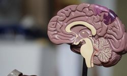 19 yaşındaki erkeğe Alzheimer teşhisi kondu: Dünyanın en genç vakası