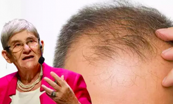 Canan Karatay'dan erkeklere: Saç döküyor