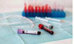 Kan Grupları ve Zeka: Bilim İnsanlarından Çarpıcı Açıklamalar