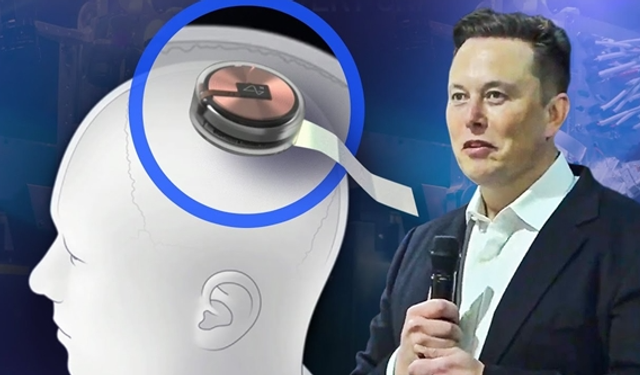 Elon Musk'un Neuralink Girişimi Yasal Sorunlarla Karşı Karşıya